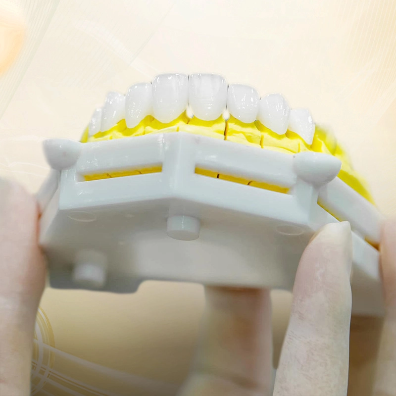 Răng toàn sứ là dòng răng sứ thế hệ mới, được chế tác từ 100% vật liệu sứ nguyên khối